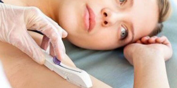 IMPLANON PELO SUS EM GUAPIMIRIM