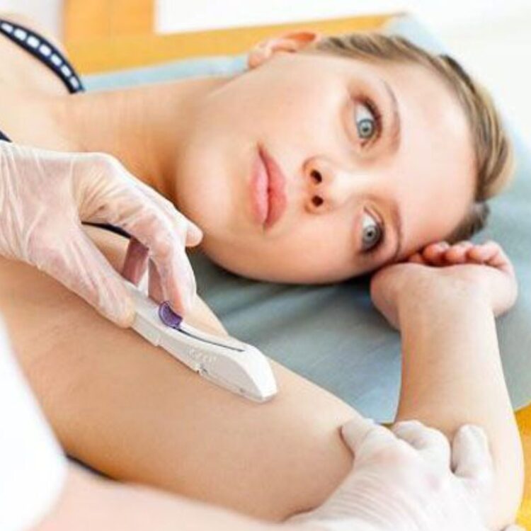 IMPLANON PELO SUS EM GUAPIMIRIM