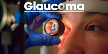 Campanha alerta sobre glaucoma e reforça diagnóstico precoce