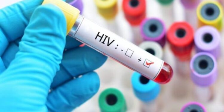 Fiocruz conclui transferência de tecnologia para produzir principal medicamento contra o HIV no Brasil