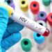 Fiocruz conclui transferência de tecnologia para produzir principal medicamento contra o HIV no Brasil